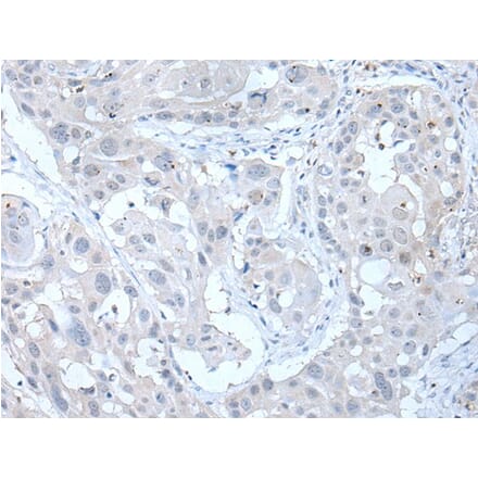 ANGPTL6 Antibody from Signalway Antibody (43761) - Antibodies.com