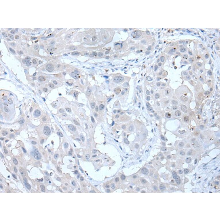 ANGPTL6 Antibody from Signalway Antibody (43761) - Antibodies.com