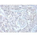 ANGPTL6 Antibody from Signalway Antibody (43761) - Antibodies.com