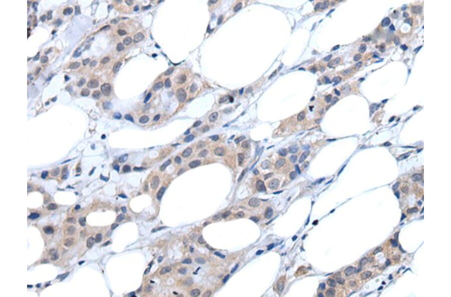 ANGPTL6 Antibody from Signalway Antibody (43761) - Antibodies.com