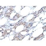 ANGPTL6 Antibody from Signalway Antibody (43761) - Antibodies.com