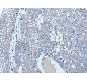 ZC3HAV1 Antibody from Signalway Antibody (43784) - Antibodies.com