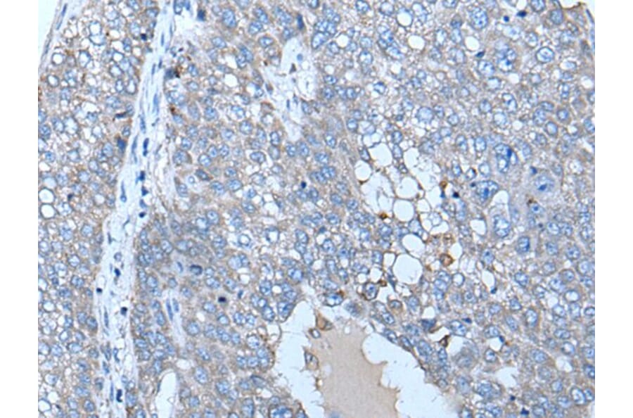 ZC3HAV1 Antibody from Signalway Antibody (43784) - Antibodies.com