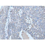 ZC3HAV1 Antibody from Signalway Antibody (43784) - Antibodies.com