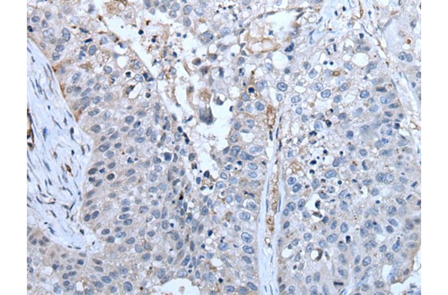 ZC3HAV1 Antibody from Signalway Antibody (43784) - Antibodies.com