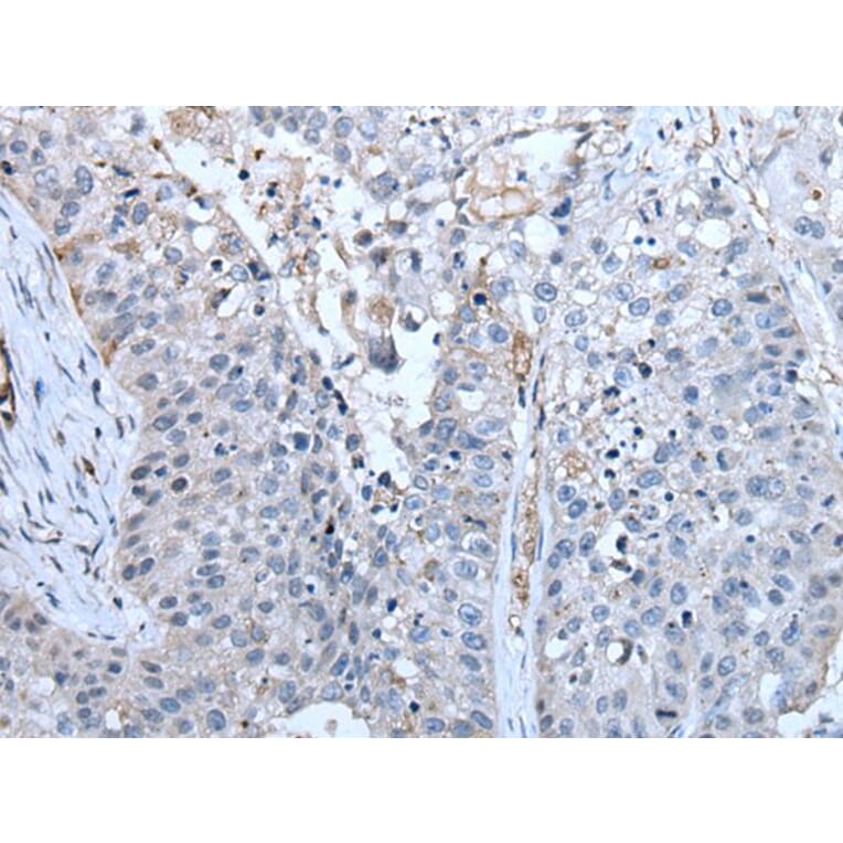 ZC3HAV1 Antibody from Signalway Antibody (43784) - Antibodies.com