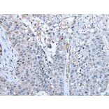 ZC3HAV1 Antibody from Signalway Antibody (43784) - Antibodies.com