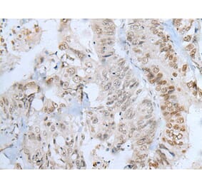 ZNF143 Antibody from Signalway Antibody (43787) - Antibodies.com