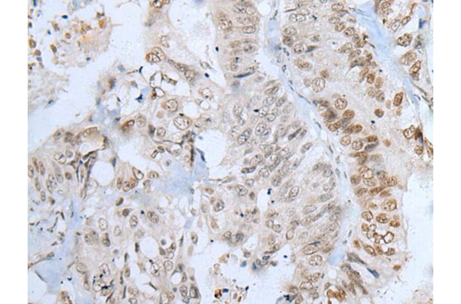 ZNF143 Antibody from Signalway Antibody (43787) - Antibodies.com