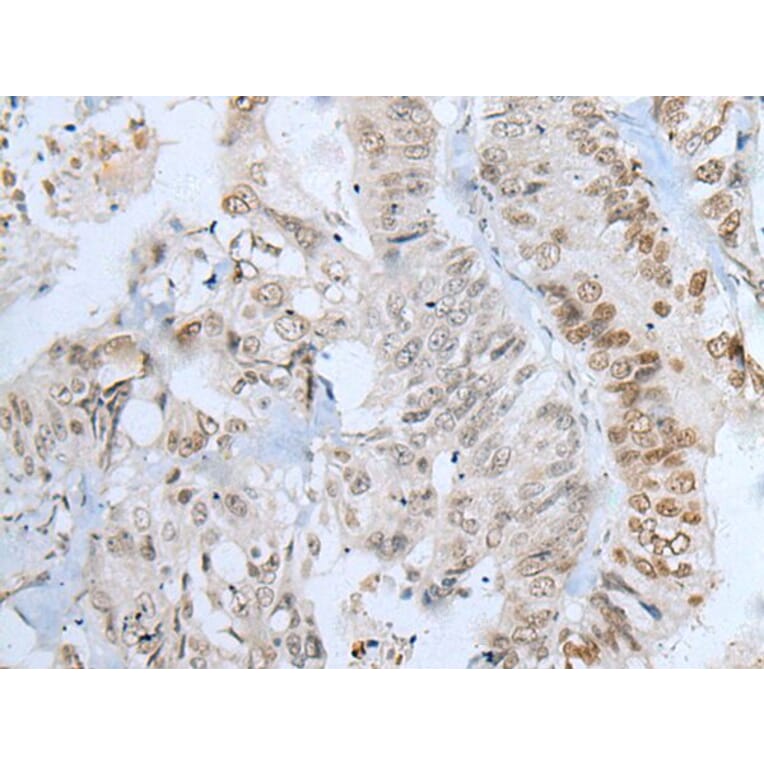 ZNF143 Antibody from Signalway Antibody (43787) - Antibodies.com