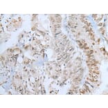 ZNF143 Antibody from Signalway Antibody (43787) - Antibodies.com