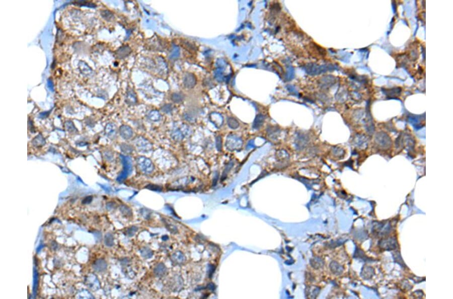 UGT2B15 Antibody from Signalway Antibody (43835) - Antibodies.com