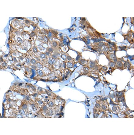 UGT2B15 Antibody from Signalway Antibody (43835) - Antibodies.com