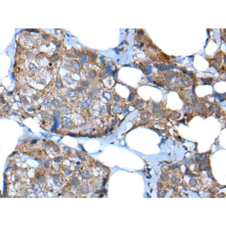 UGT2B15 Antibody from Signalway Antibody (43835) - Antibodies.com