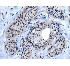 UNC93B1 Antibody from Signalway Antibody (43838) - Antibodies.com