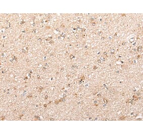 CYP11B2 Antibody from Signalway Antibody (43862) - Antibodies.com