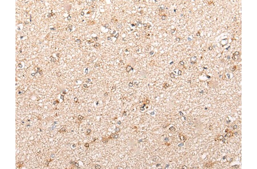 CYP11B2 Antibody from Signalway Antibody (43862) - Antibodies.com