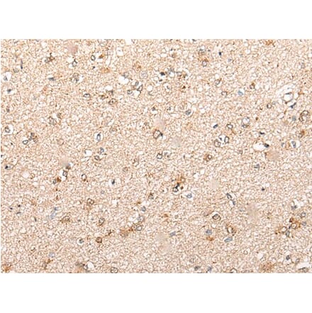 CYP11B2 Antibody from Signalway Antibody (43862) - Antibodies.com