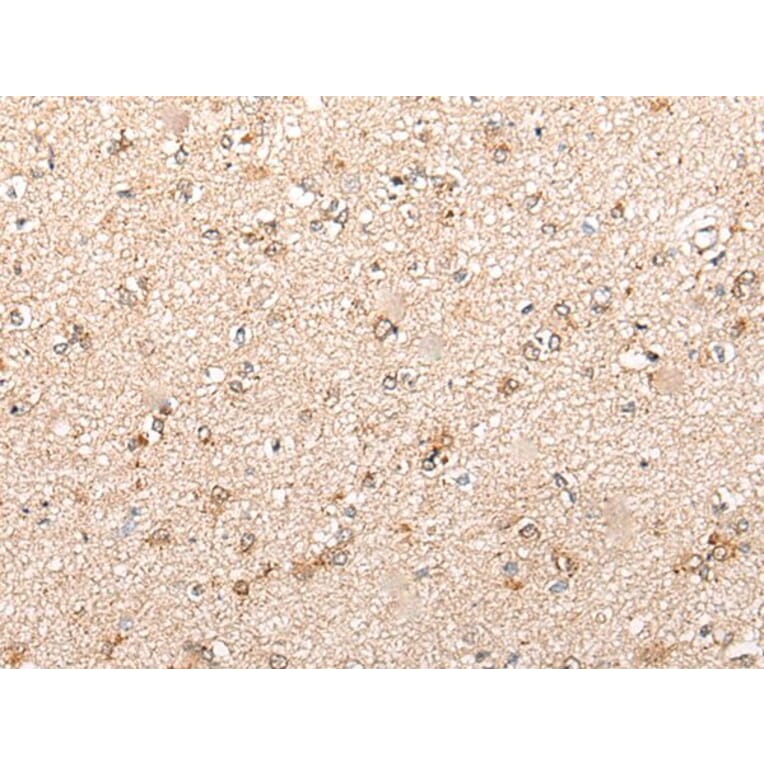 CYP11B2 Antibody from Signalway Antibody (43862) - Antibodies.com