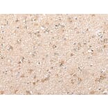 CYP11B2 Antibody from Signalway Antibody (43862) - Antibodies.com