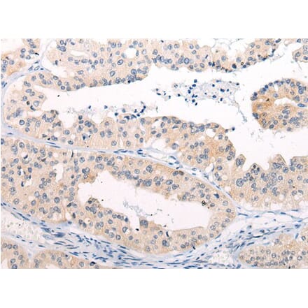 ANAPC15 Antibody from Signalway Antibody (43865) - Antibodies.com