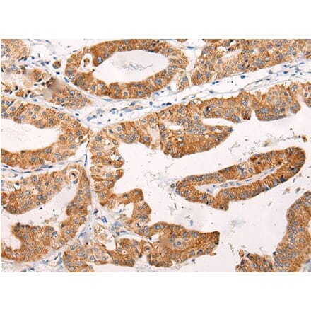 C14orf2 Antibody from Signalway Antibody (43868) - Antibodies.com