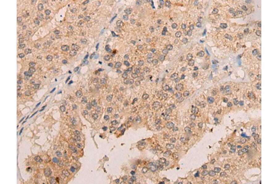 FAM234A Antibody from Signalway Antibody (43873) - Antibodies.com