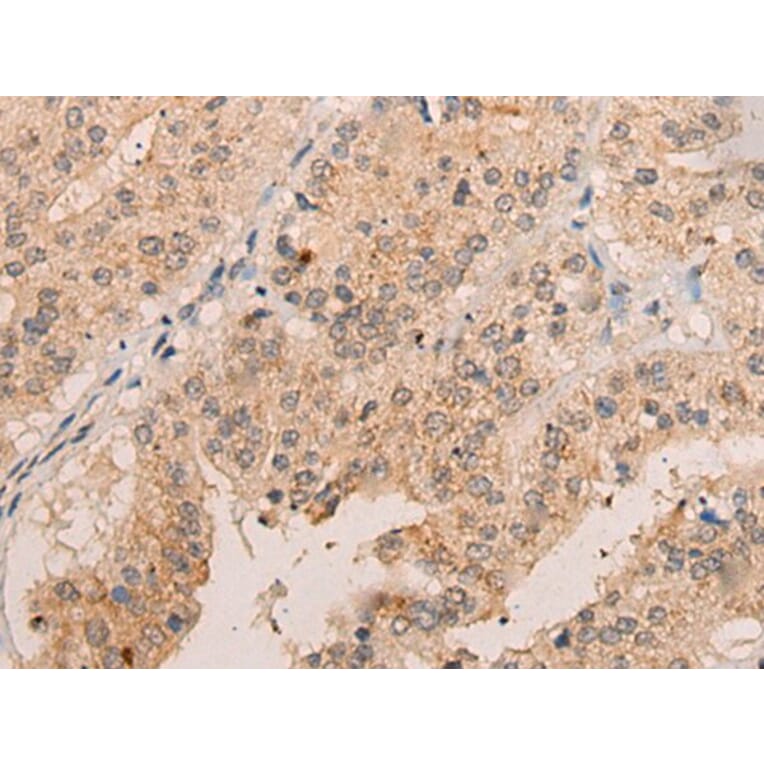 FAM234A Antibody from Signalway Antibody (43873) - Antibodies.com