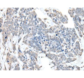 ANKRD27 Antibody from Signalway Antibody (43897) - Antibodies.com