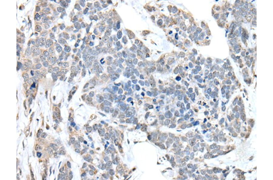 ANKRD27 Antibody from Signalway Antibody (43897) - Antibodies.com