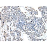 ANKRD27 Antibody from Signalway Antibody (43897) - Antibodies.com