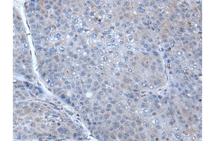 SCGB3A1 Antibody from Signalway Antibody (43908) - Antibodies.com