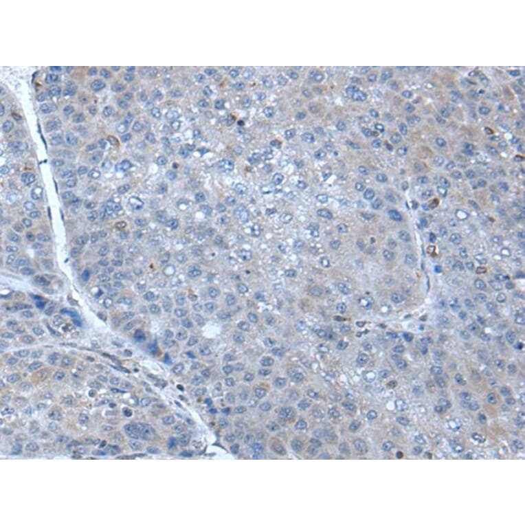 SCGB3A1 Antibody from Signalway Antibody (43908) - Antibodies.com