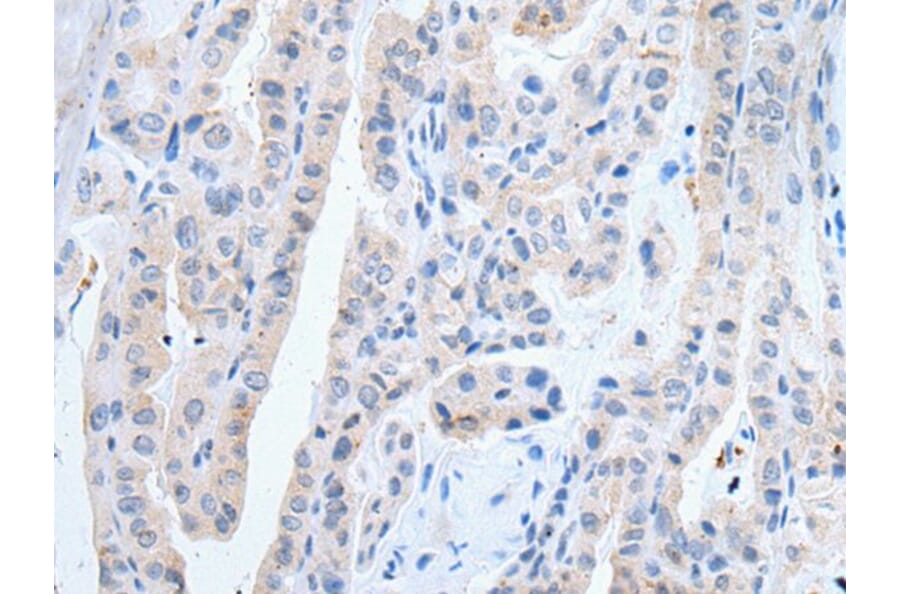 SLCO2B1 Antibody from Signalway Antibody (43910) - Antibodies.com