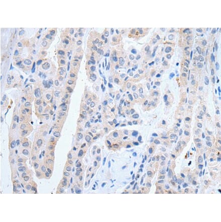 SLCO2B1 Antibody from Signalway Antibody (43910) - Antibodies.com