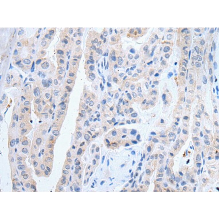 SLCO2B1 Antibody from Signalway Antibody (43910) - Antibodies.com