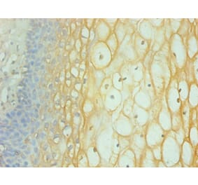 Immunohistochemistry - Interferon gamma Monoclonal Antibody from Signalway Antibody (42034) - Antibodies.com