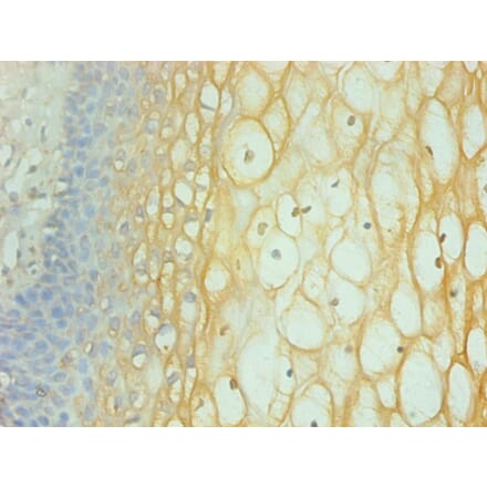 Immunohistochemistry - Interferon gamma Monoclonal Antibody from Signalway Antibody (42034) - Antibodies.com