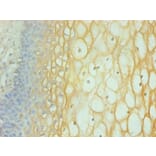 Immunohistochemistry - Interferon gamma Monoclonal Antibody from Signalway Antibody (42034) - Antibodies.com