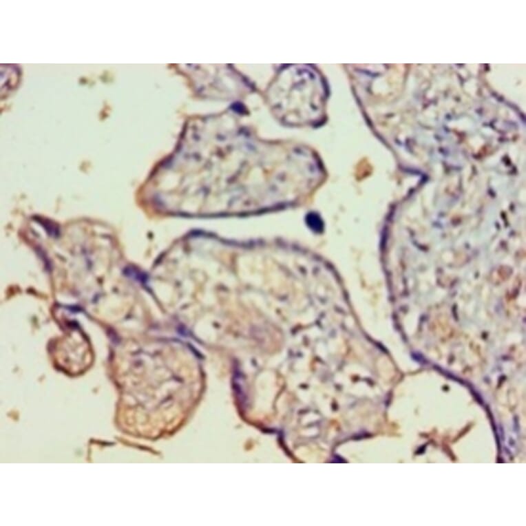 Immunohistochemistry - Protein FAM160B1 Polyclonal Antibody from Signalway Antibody (42657) - Antibodies.com