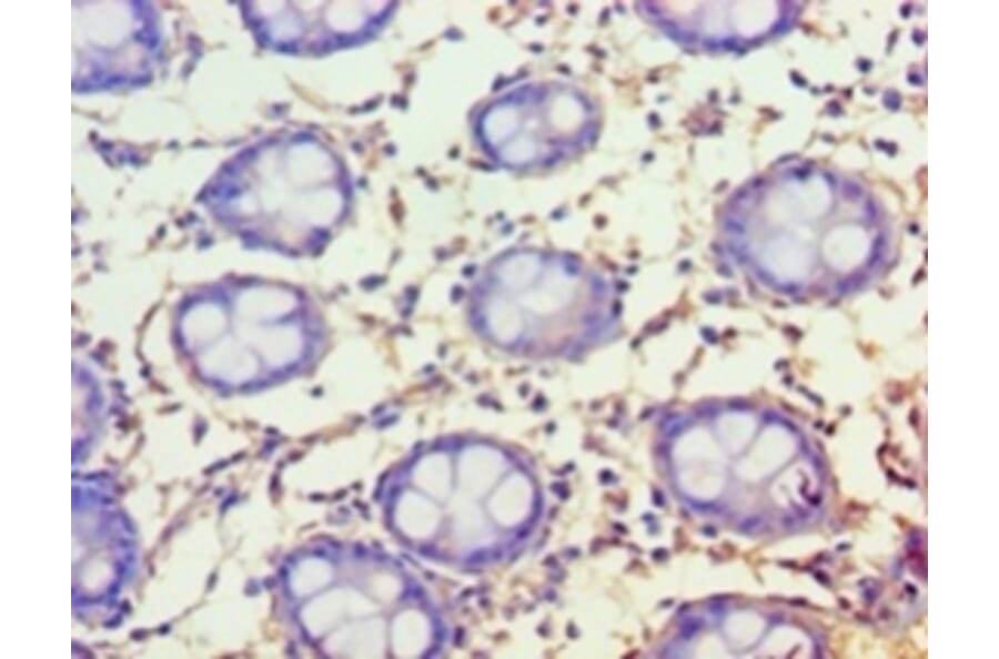 Immunohistochemistry - Protein FAM160B1 Polyclonal Antibody from Signalway Antibody (42657) - Antibodies.com
