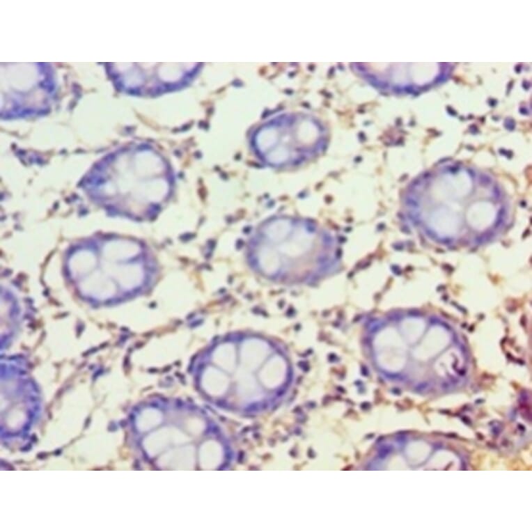 Immunohistochemistry - Protein FAM160B1 Polyclonal Antibody from Signalway Antibody (42657) - Antibodies.com