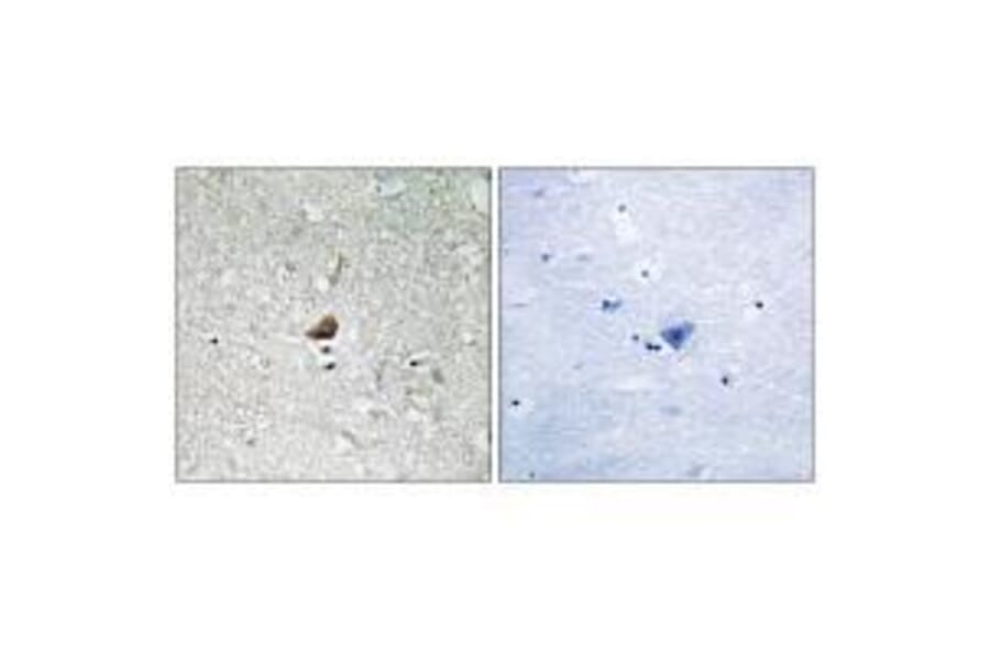 Immunohistochemistry - IRAK1 Antibody from Signalway Antibody (33231) - Antibodies.com