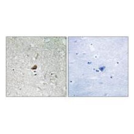 Immunohistochemistry - IRAK1 Antibody from Signalway Antibody (33231) - Antibodies.com