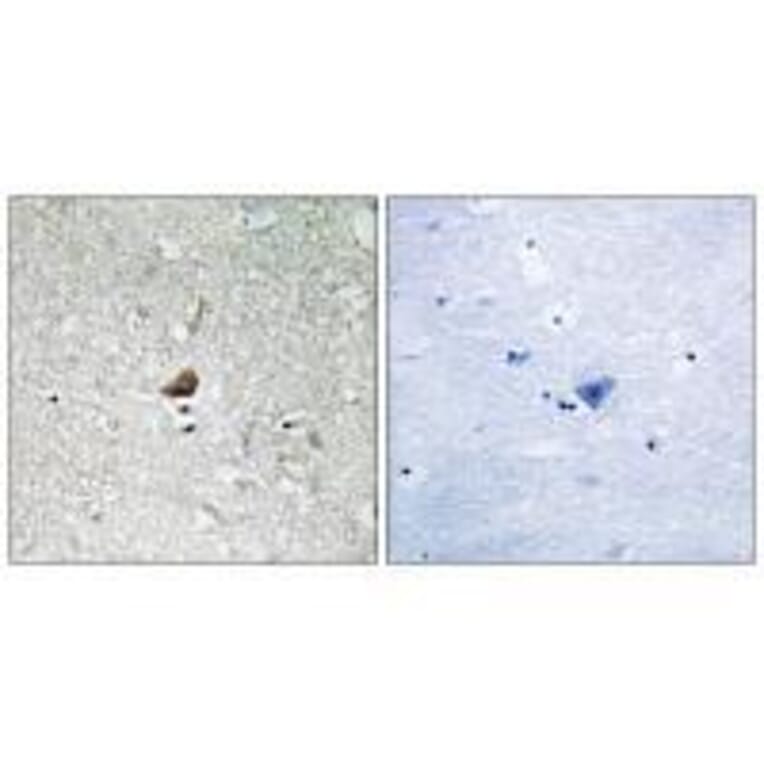 Immunohistochemistry - IRAK1 Antibody from Signalway Antibody (33231) - Antibodies.com