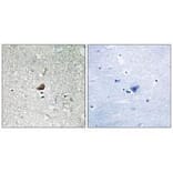 Immunohistochemistry - IRAK1 Antibody from Signalway Antibody (33231) - Antibodies.com