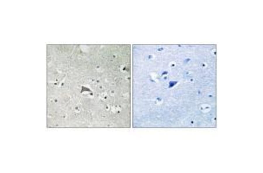 Immunohistochemistry - VEGFR1 Antibody from Signalway Antibody (33253) - Antibodies.com