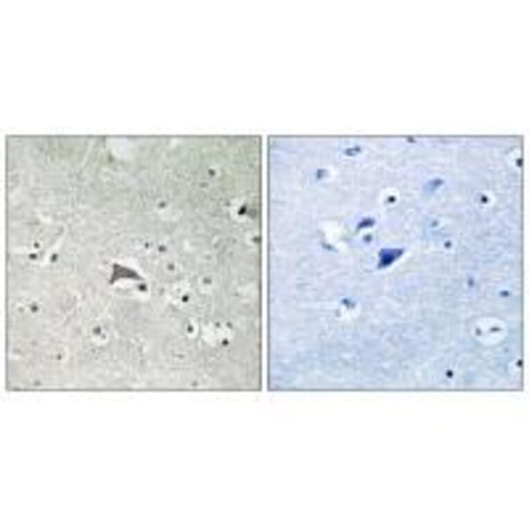 Immunohistochemistry - VEGFR1 Antibody from Signalway Antibody (33253) - Antibodies.com