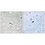 Immunohistochemistry - VEGFR1 Antibody from Signalway Antibody (33253) - Antibodies.com