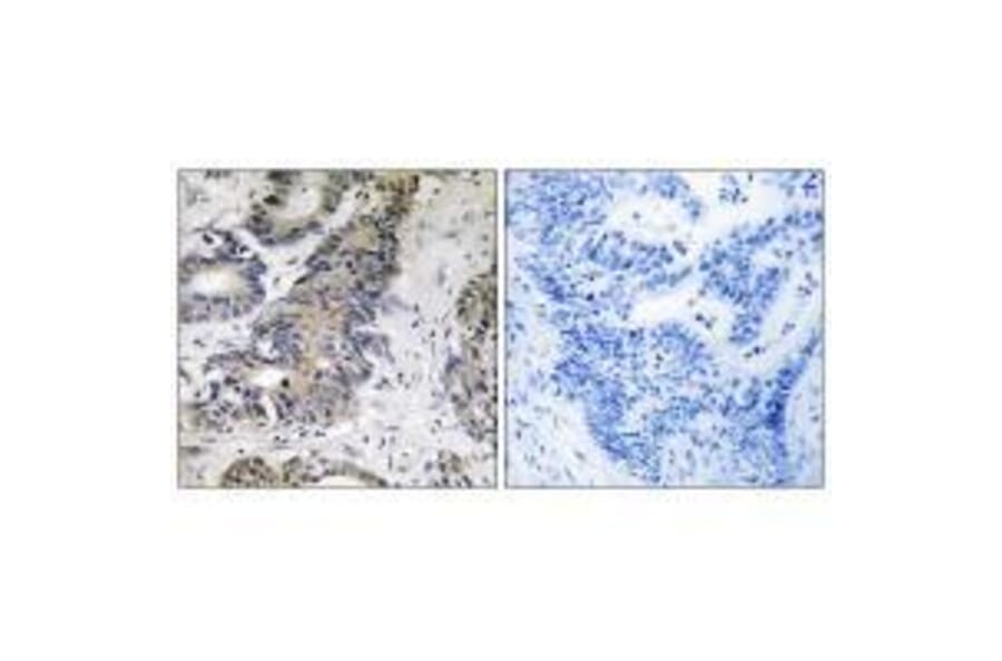 Immunohistochemistry - 4E-BP1 Antibody from Signalway Antibody (33269) - Antibodies.com